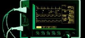 Heart Monitor